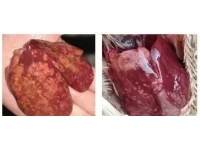 關(guān)于弧菌性肝炎